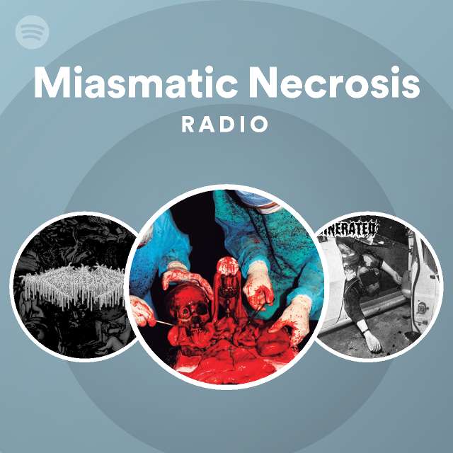 Miasmatic Necrosis Radio 